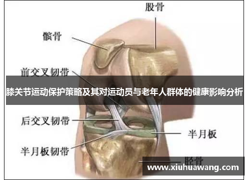 膝关节运动保护策略及其对运动员与老年人群体的健康影响分析
